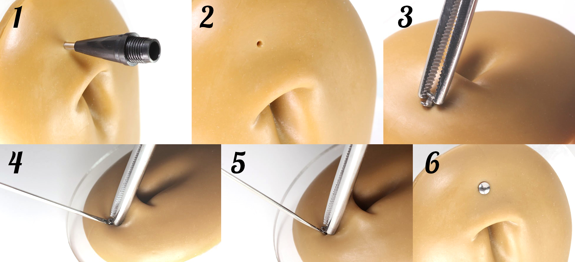 Attrezzo per assistere il dermal anchor